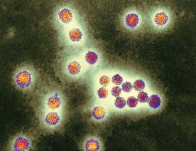 Papillomavirus vireons seen in a colored transmission electron micrograph