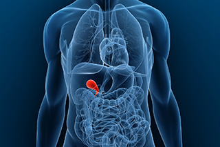 Is gallbladder cancer inherited?