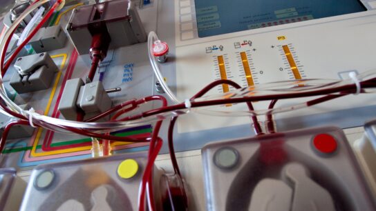 Apheresis machine collecting stem cells for transplant