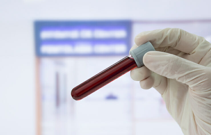 medical technician gloved hand holding blood sample in tube