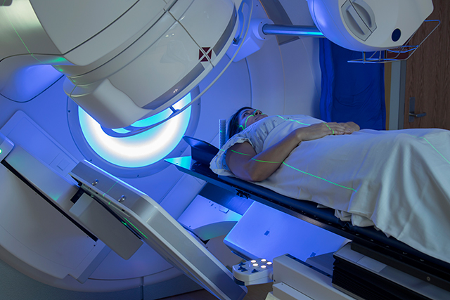 Radiotherapy for breast cancer