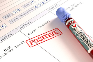 A dual diagnosis of both cancer and HIV places a greater psychosocial burden on the patient.