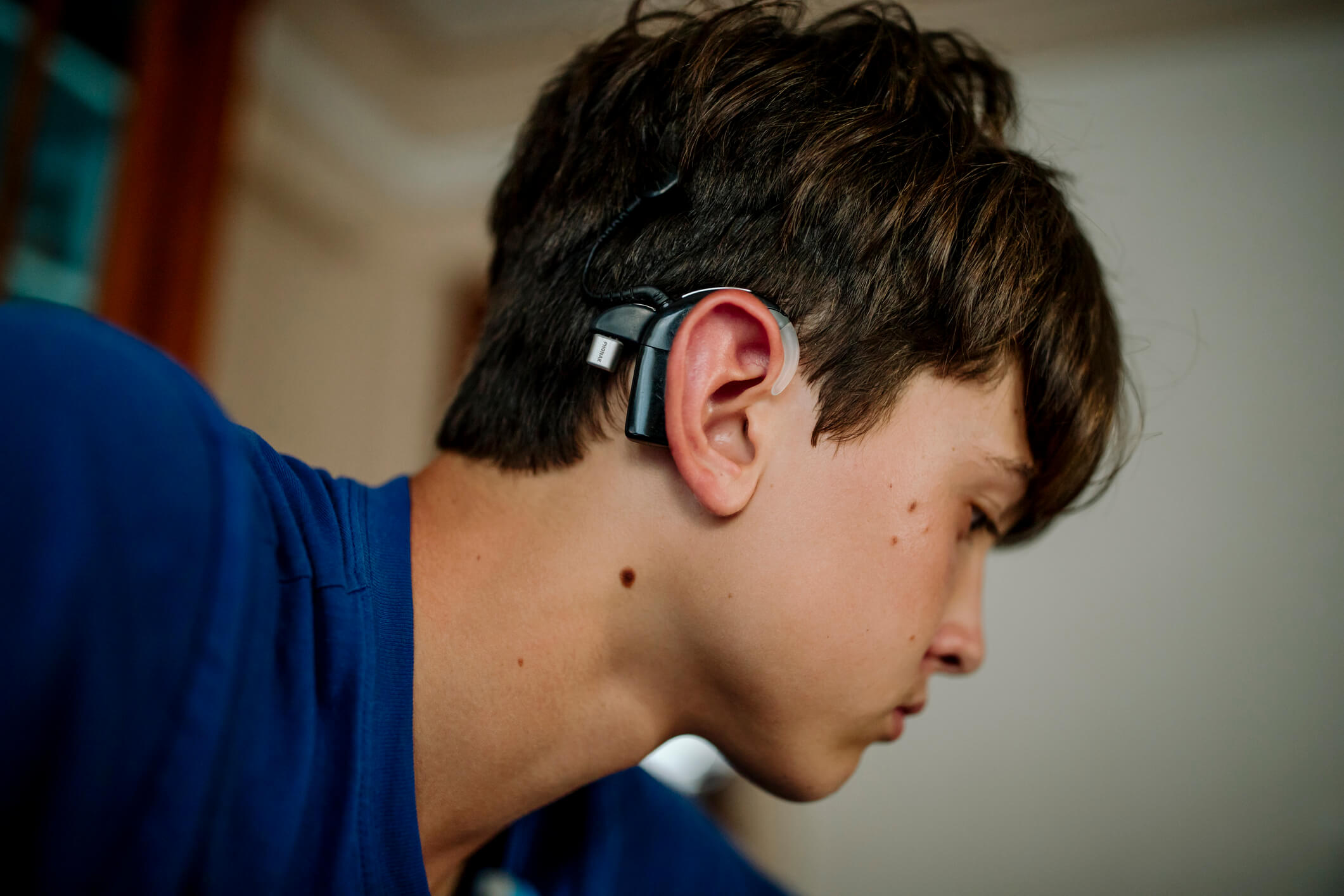 Young male patient with a cochlear hearing aid.