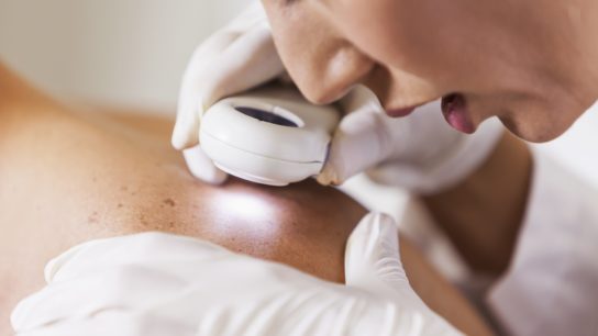 A dermatologist examines a patient's skin, carefully looking at a mole for signs of skin cancer.