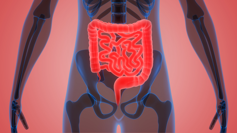 Rarely, patients with prostate cancer will develop metastases to the gastrointestinal tract, which l