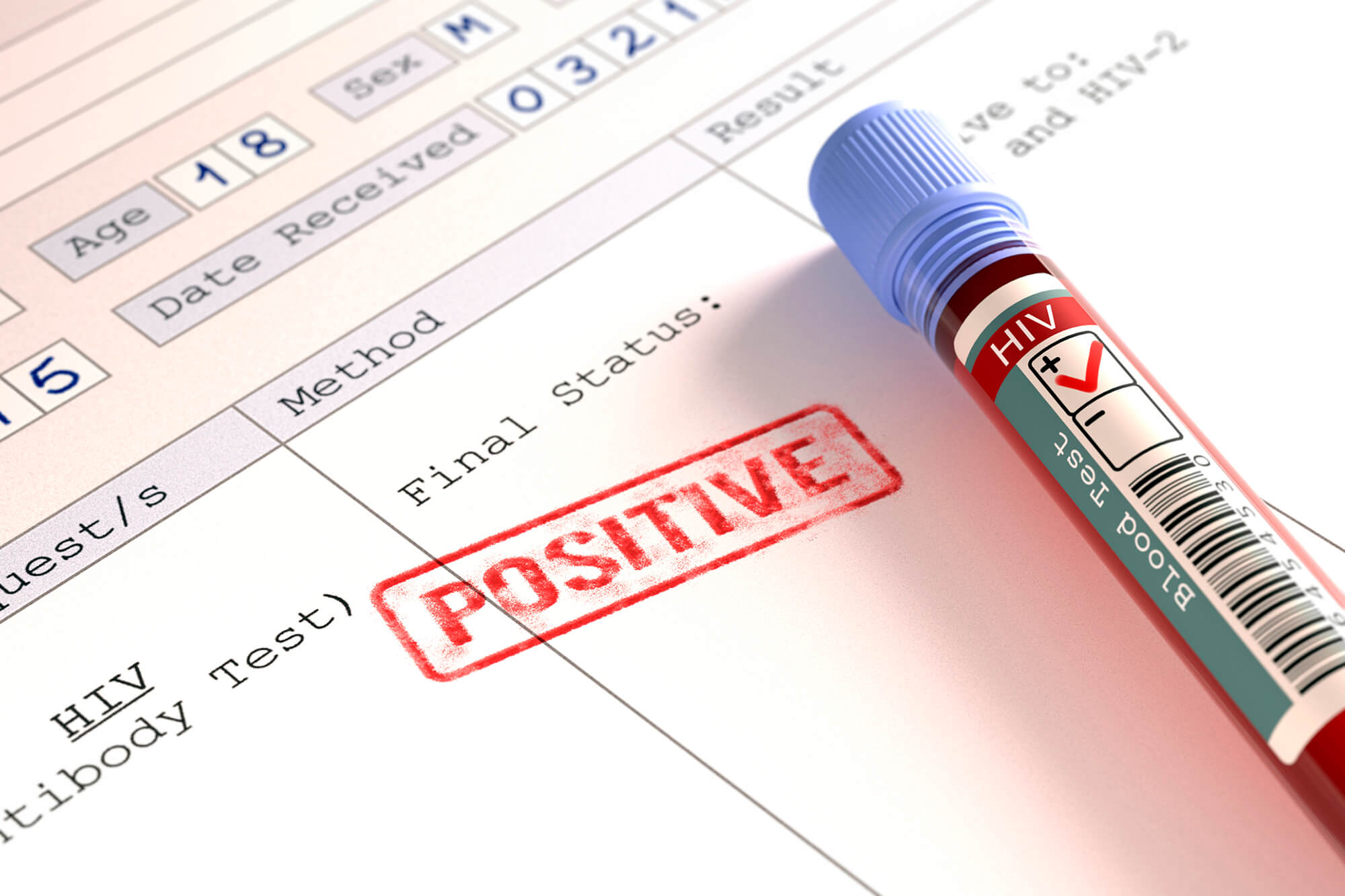 Positive HIV status