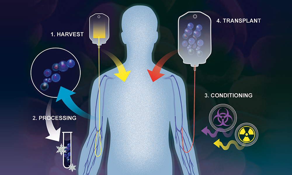 Researchers conducted a meta-analysis of studies evaluating survival outcomes with rituximab plus chemotherapy with or without autologous HSCT.