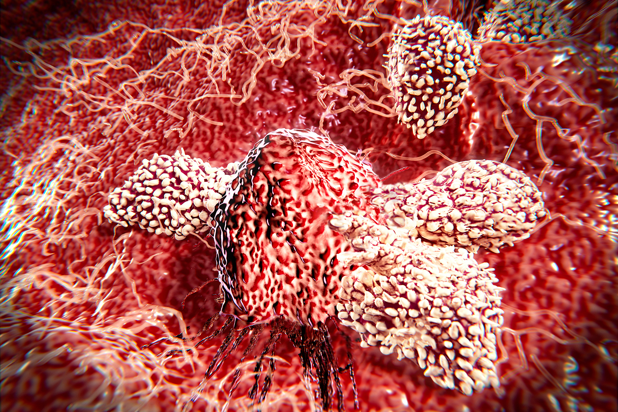 T-lymphocytes attacking a cancer cell.