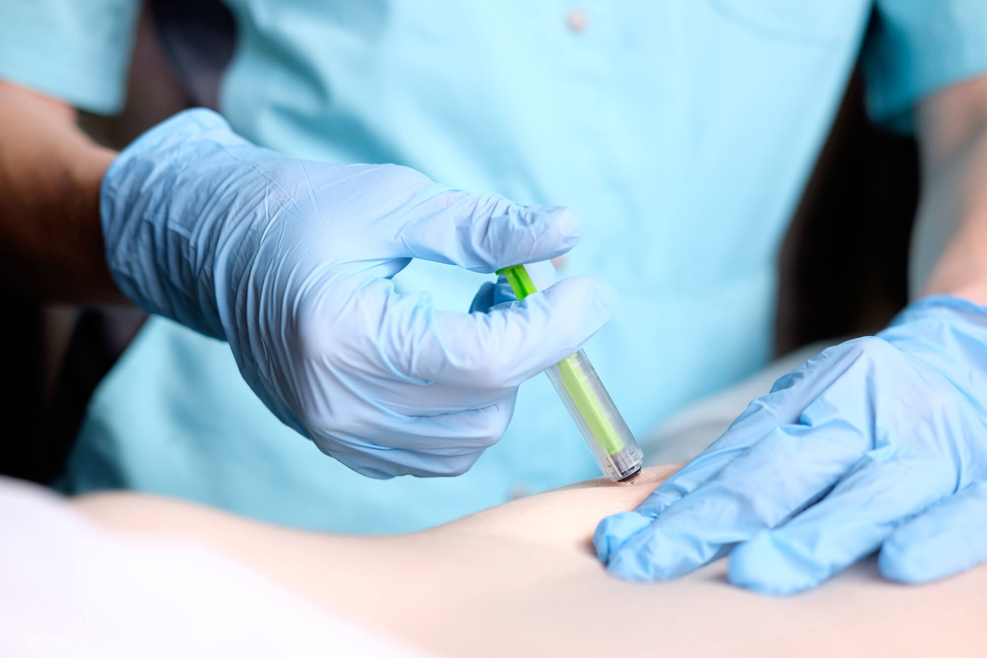 Nurse making injection of anticoagulant subcutaneously.