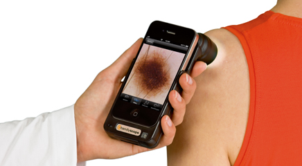 Smartphone Melanoma Screening Apps