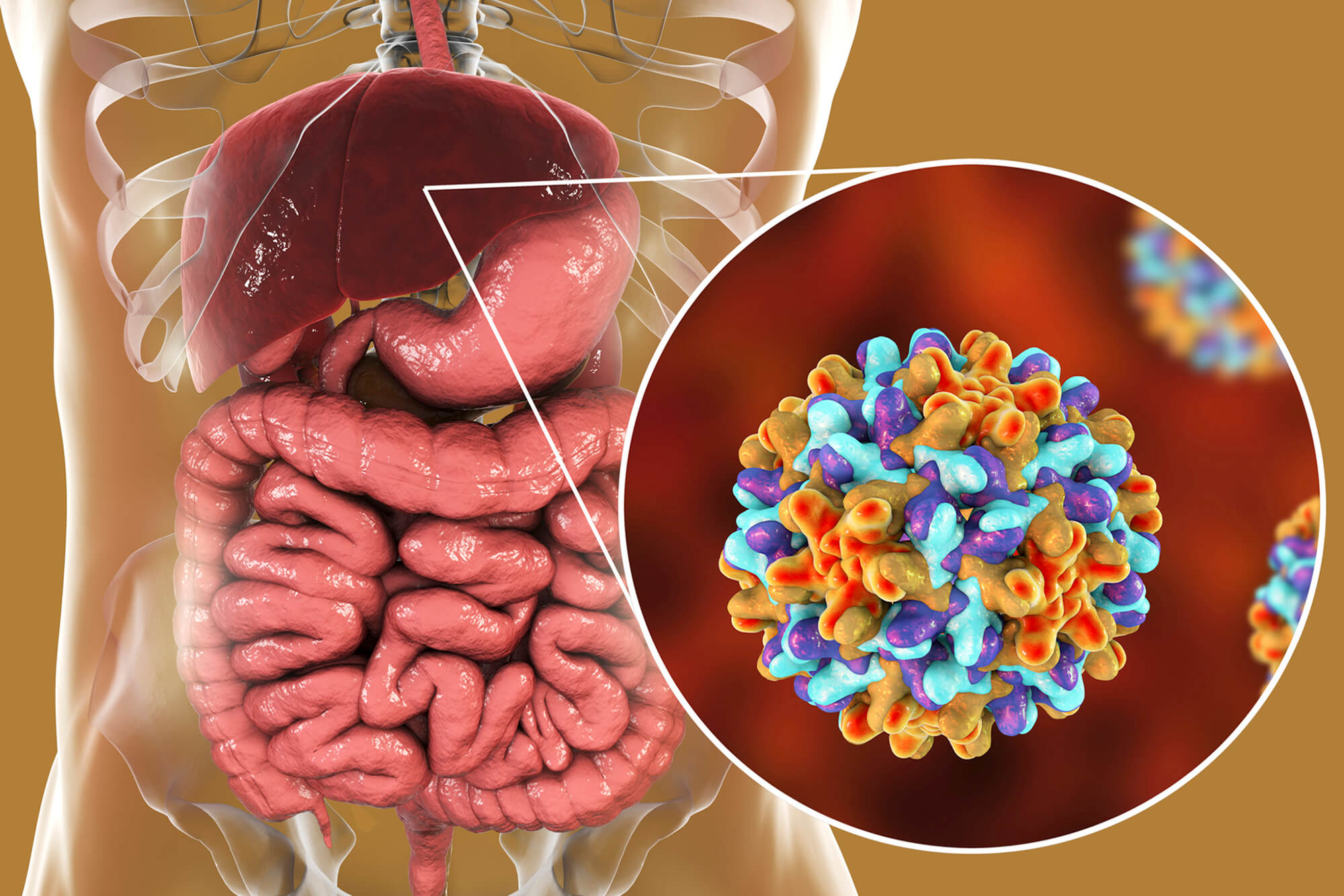 Hepatitis B infection of the liver