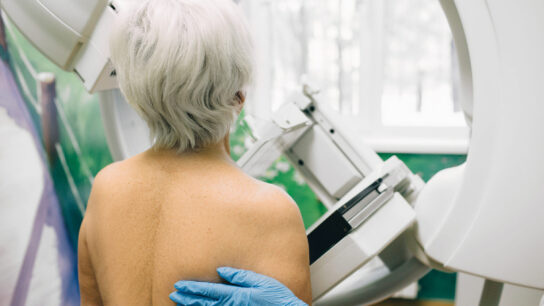 Senior woman having a mammography scan at hospital