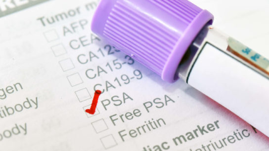 Image of PSA screening.