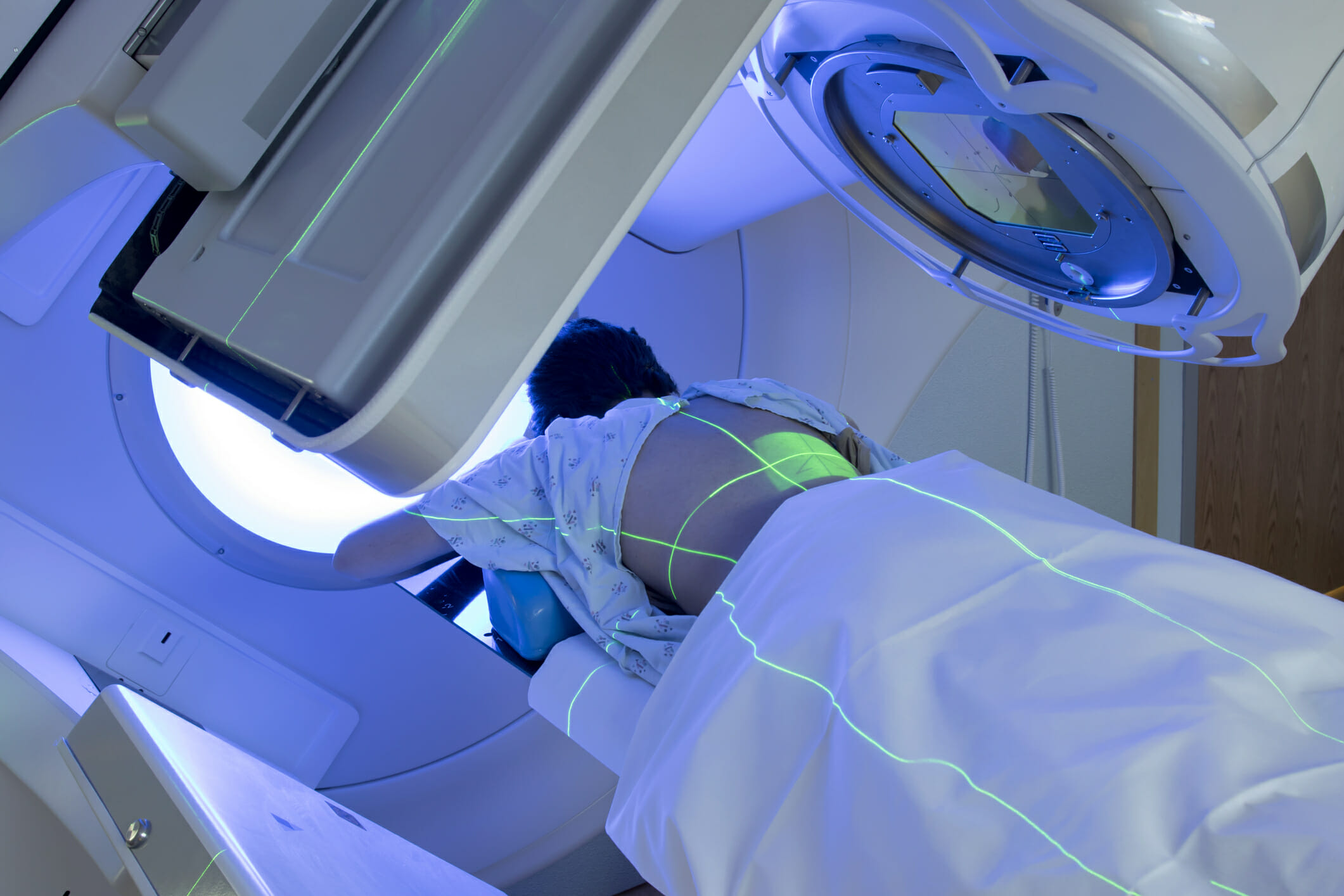 Patient receiving radiation for thoracic cancer