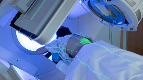 A patient receives radiotherapy treatments for thoracic cancer.