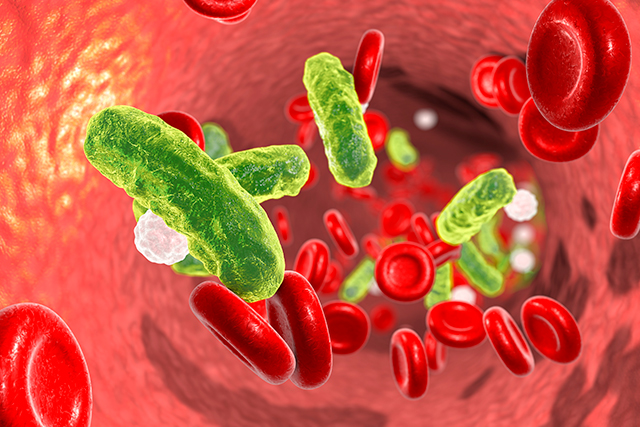 Sepsis, bacteria in blood