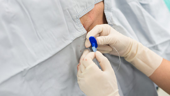 Administering a spinal catheter