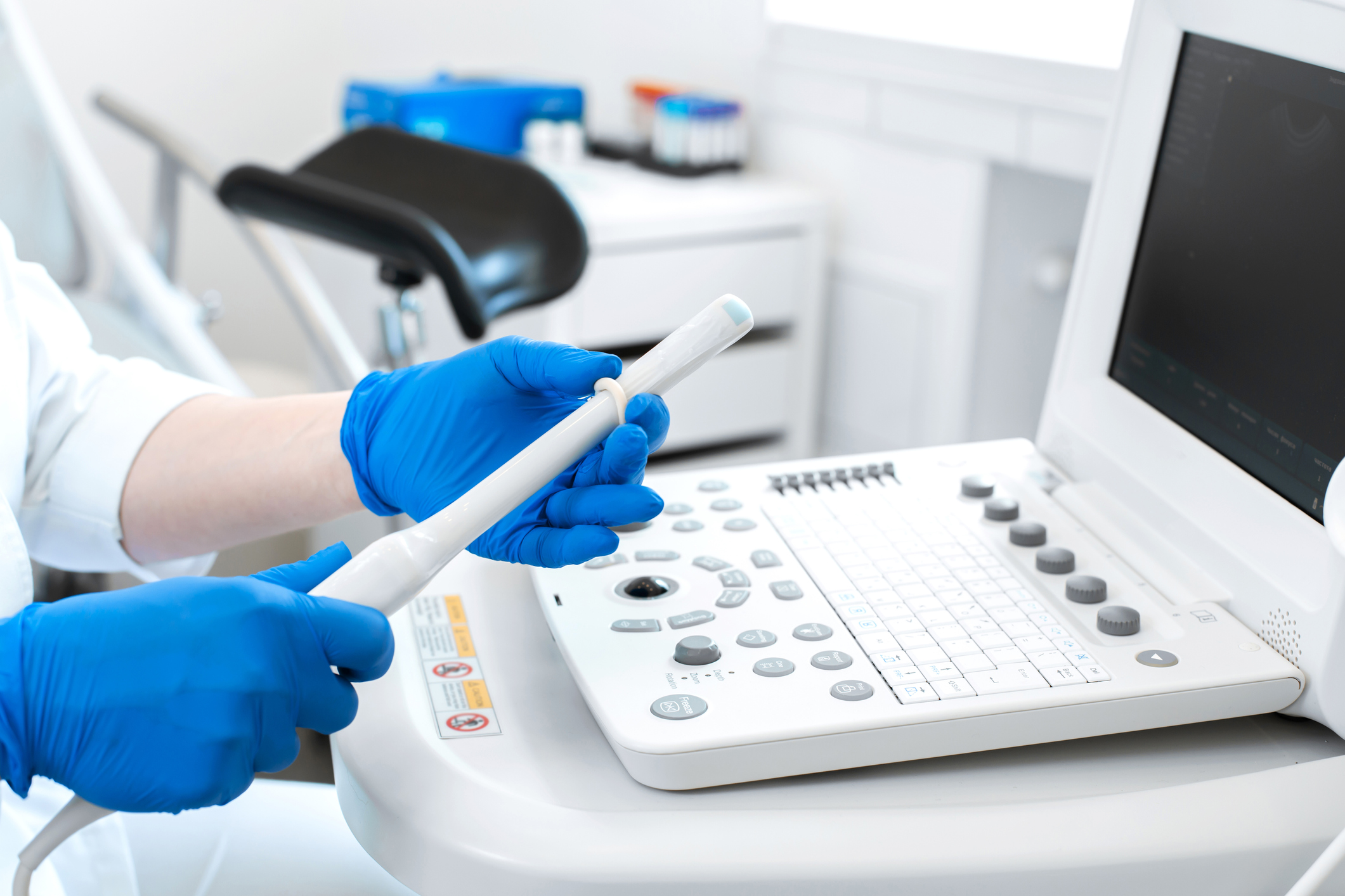 gynecologist doctor prepares an ultrasound machine for the diagnosis of the patient.