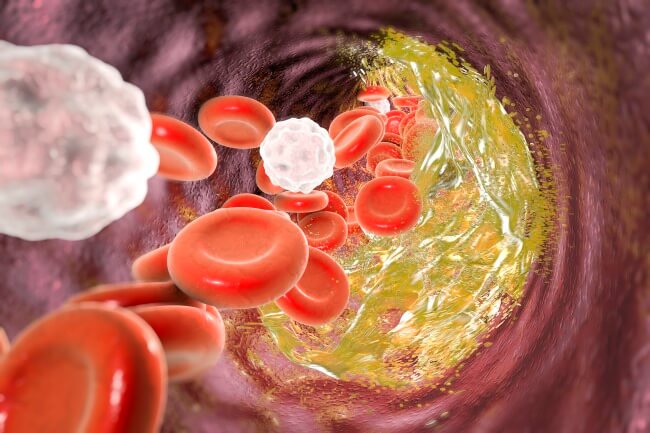 A new study aims to address the conundrum of coagulation risk in patients hospitalized for hematologic malignancies.